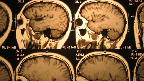 Mózg rośnie najszybciej w ciągu pierwszych trzech miesięcy życia